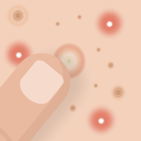 Гладкая Кожа — Убрать Прыщи для iOS