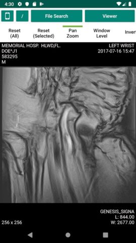 Dicom File Viewer для Android — скриншот 2