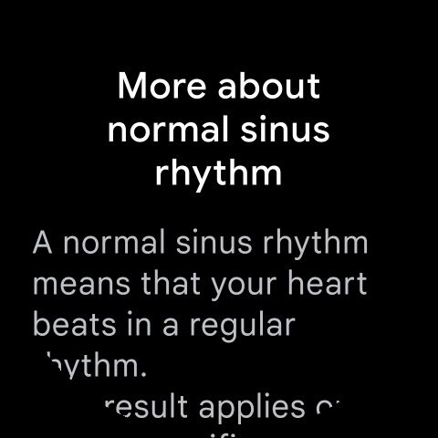 Fitbit ECG App для Android — скриншот 5