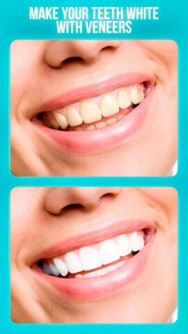 Зубной врач — редактор для Android — скриншот 1