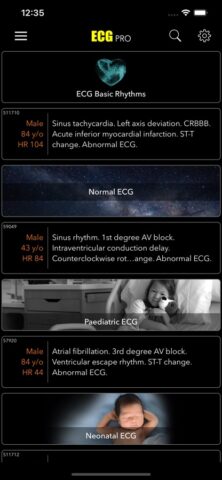 ECG for Doctors для iOS — скриншот 1