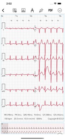 ECG for Doctors для iOS — скриншот 2