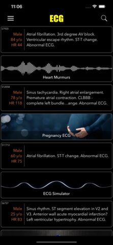 ECG for Doctors для iOS — скриншот 3