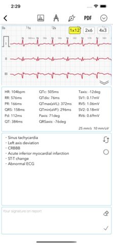 ECG for Doctors для iOS — скриншот 4
