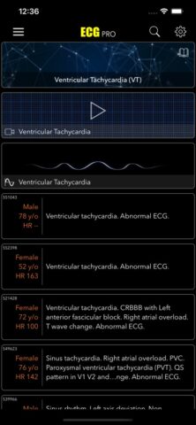 ECG for Doctors для iOS — скриншот 5