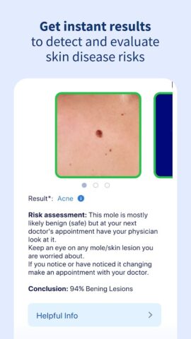 AI Dermatologist: Skin Scanner для Android — скриншот 4