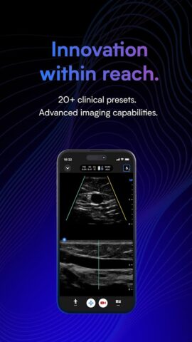 Butterfly iQ — Ultrasound для Android — скриншот 2