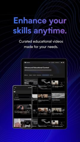 Butterfly iQ — Ultrasound для Android — скриншот 4