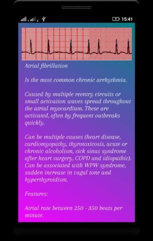 Интерпретация ЭКГ (ECG Interp) для Android — скриншот 4