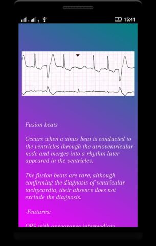 Интерпретация ЭКГ (ECG Interp) для Android — скриншот 5