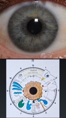 Eye Diagnosis для Android — скриншот 3