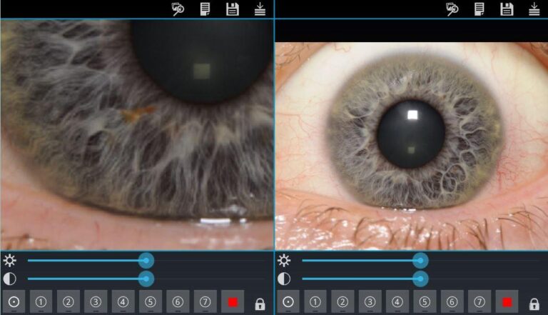 Eye Diagnosis для Android — скриншот 5