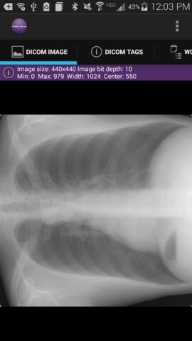 Mobile Dicom Viewer для Android — скриншот 2