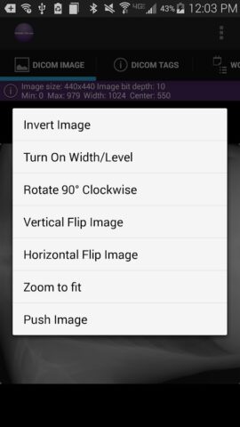 Mobile Dicom Viewer для Android — скриншот 3