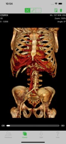 OsiriX HD для iOS — скриншот 2