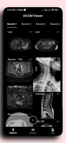 DICOM Viewer для Android — скриншот 1