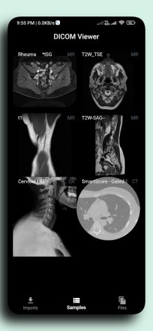 DICOM Viewer для Android — скриншот 2