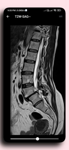 DICOM Viewer для Android — скриншот 3