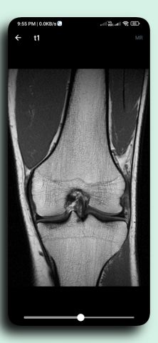 DICOM Viewer для Android — скриншот 4