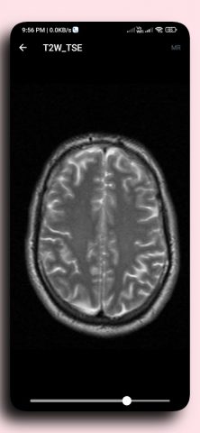 DICOM Viewer для Android — скриншот 5