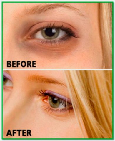 Dark Circles Tips для Android — скриншот 1