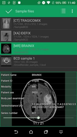 DroidRender — 3D DICOM viewer для Android — скриншот 4