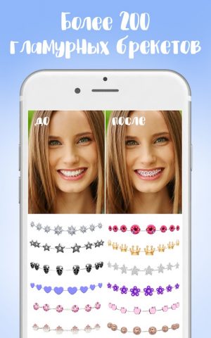 Брекеты — Braces для Android — скриншот 1