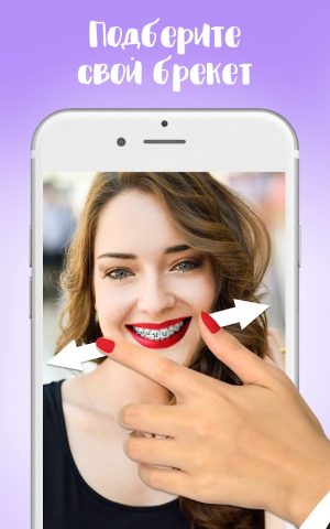 Брекеты — Braces для Android — скриншот 2