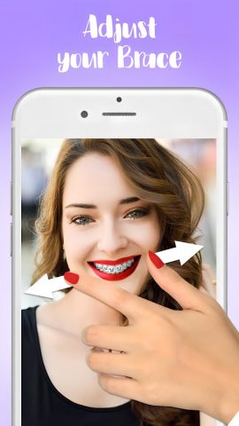 Брекеты — Braces для Android — скриншот 5