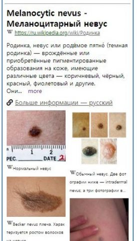 Model Dermatol – Болезнь кожи для Android — скриншот 2