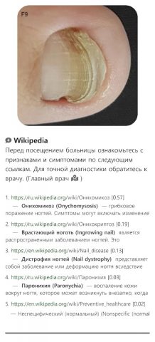Model Dermatol – Болезнь кожи для Android — скриншот 3