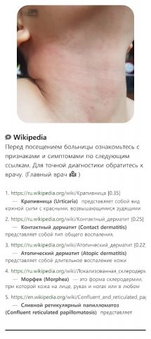 Model Dermatol – Болезнь кожи для Android — скриншот 5
