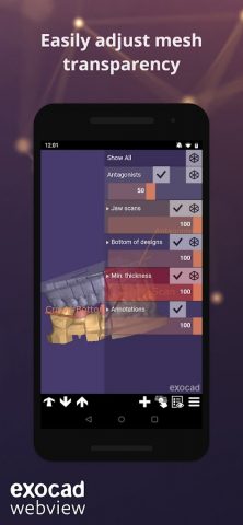 exocad webview — STL 3D Viewer для Android — скриншот 4