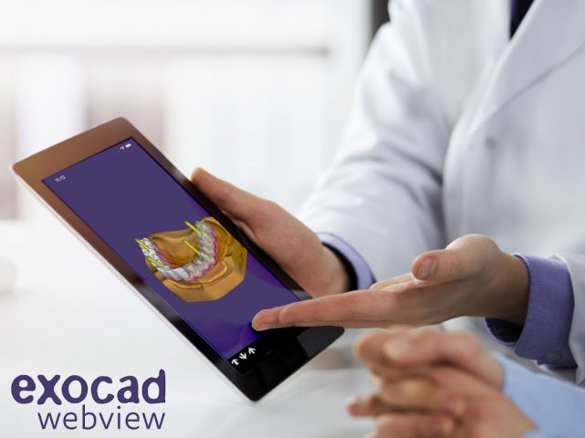 exocad webview — STL 3D Viewer для Android — скриншот 5