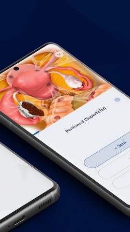 AAGL Endo Classification для Android — скриншот 3