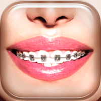 Брекеты на зубы 2018 — Braces для iOS