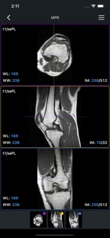 IDV — IMAIOS DICOM Viewer для iOS — скриншот 5