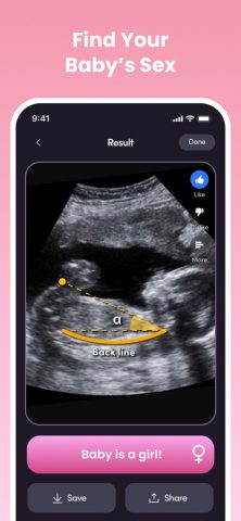 NubX: Gender Reveal& Baby Scan для iOS — скриншот 1