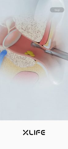 Xlife для Android — скриншот 1