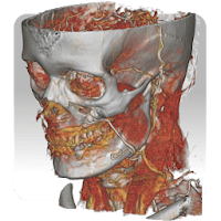 DroidRender — 3D DICOM viewer для Android