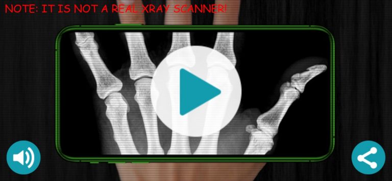 X-Ray сканер симулятор для iOS — скриншот 1
