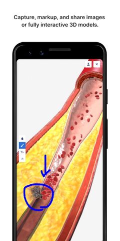 BioDigital Human — 3D Anatomy для Android — скриншот 5