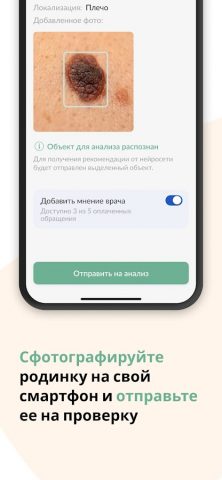 Про Родинки: здоровая кожа для Android — скриншот 1