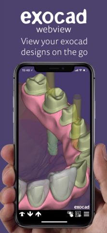 exocad webview — скриншот 1