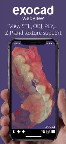 exocad webview — скриншот 2