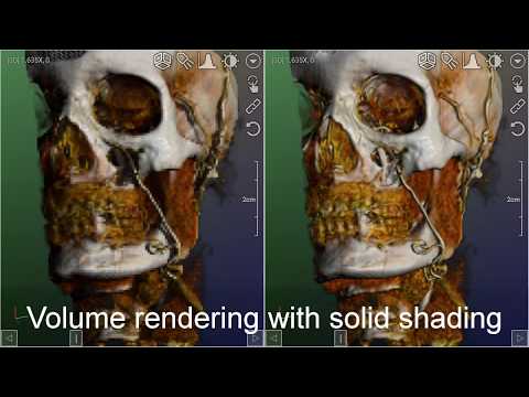 DroidRender — 3D DICOM viewer для Android — официальный трейлер
