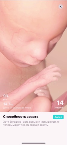 Беременность + для iOS — официальный трейлер