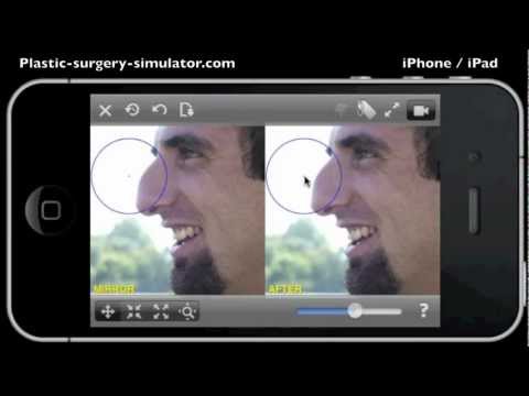 Имитация пластической хирургии для Android — официальный трейлер