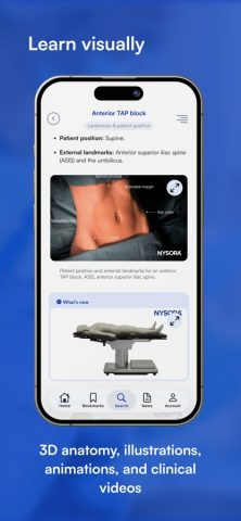 NYSORA Nerve Blocks для iOS — скриншот 3