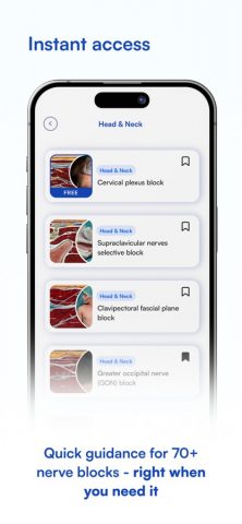 NYSORA Nerve Blocks для iOS — скриншот 4